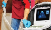 Heart Scans